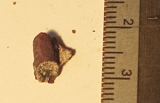 fossil?