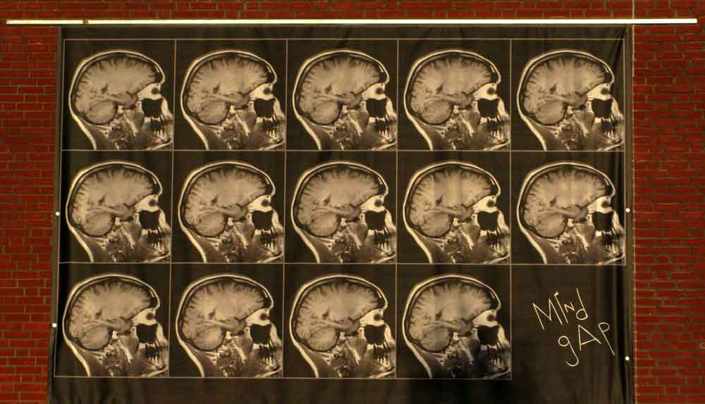 brain