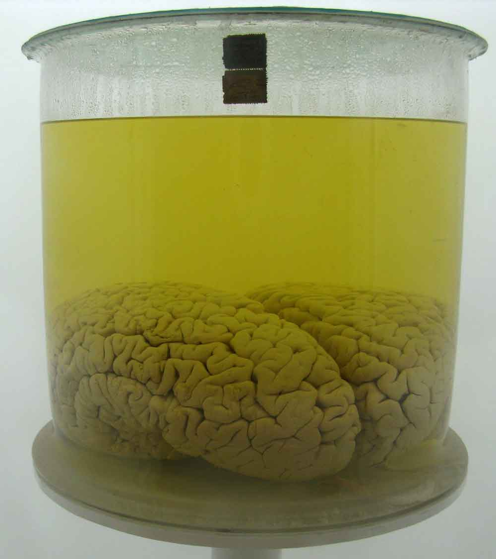 brain