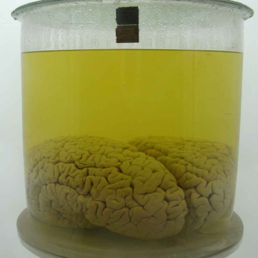 brain