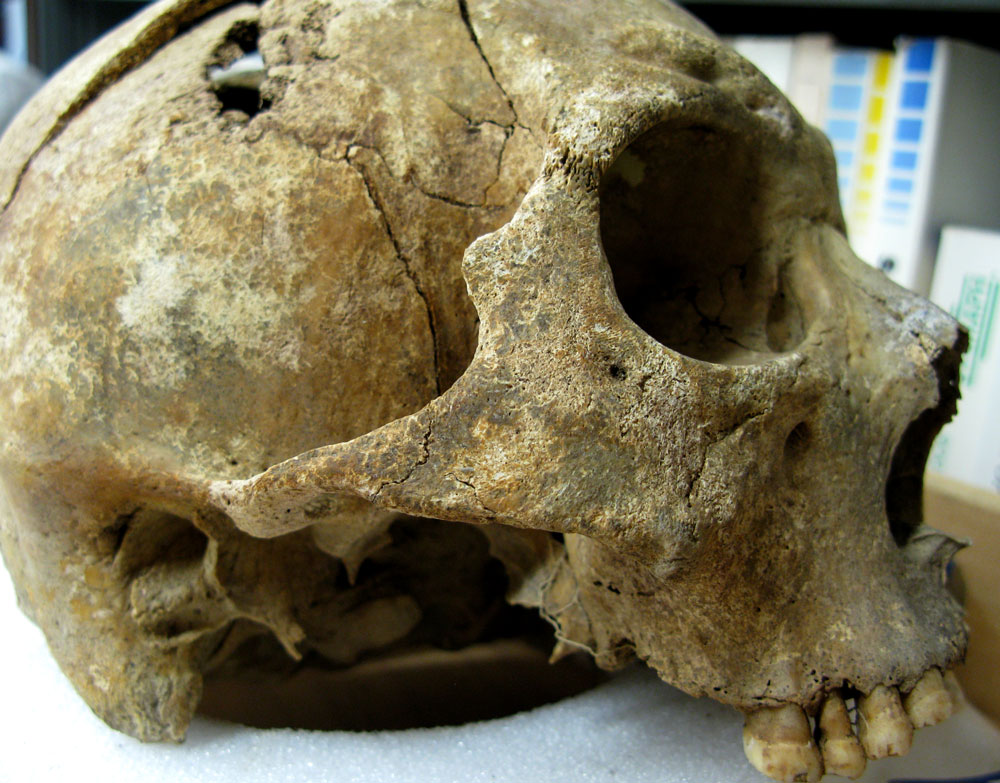 skull