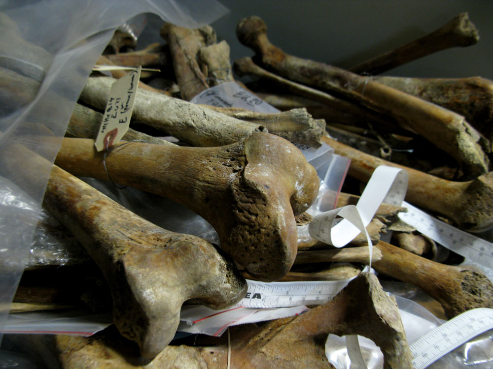 bones