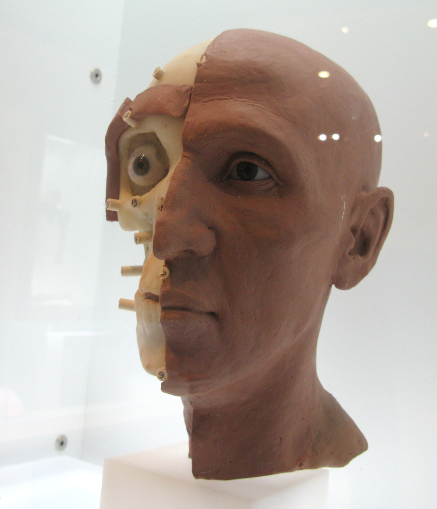 facial reconstruction