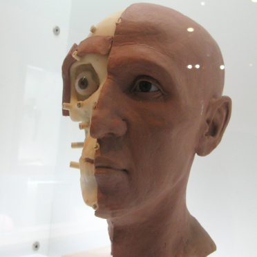 facial reconstruction