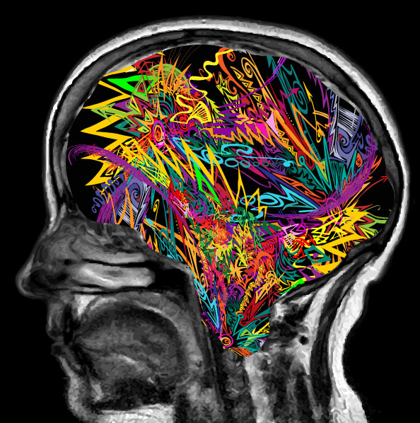 explosive brain